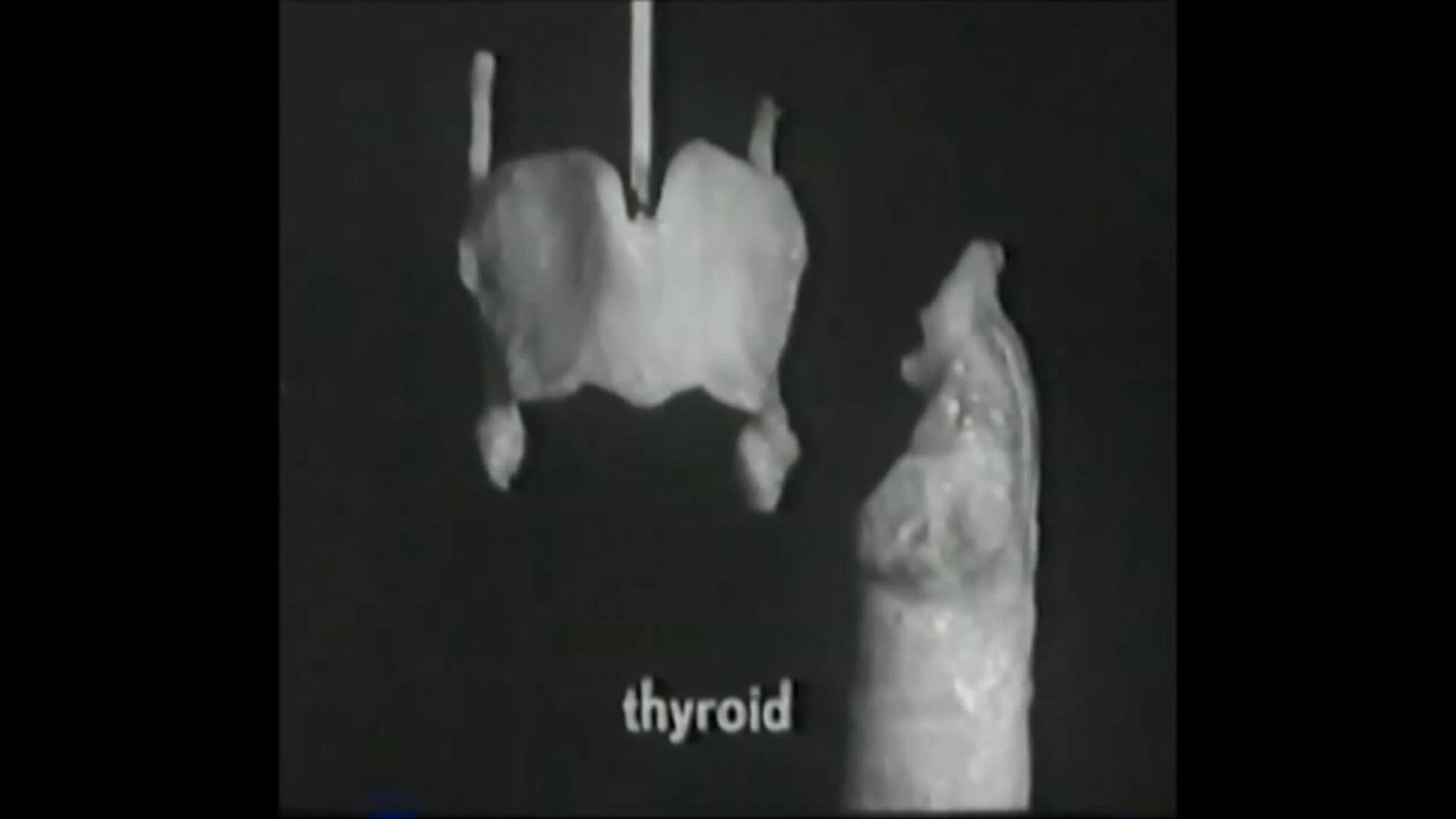Voice Production: The Vibrating Larynx